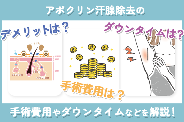 アポクリン汗腺でメリットは？手術費用やダウンタイムについて解説