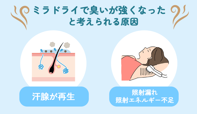 ミラドライで臭いが強くなったと考えられる原因